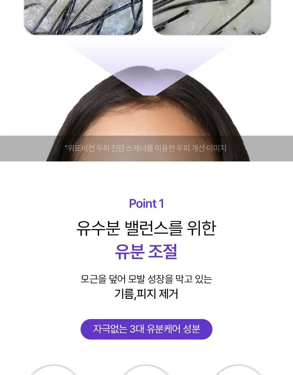 [맞춤형 탈모샴푸] 위드비컨 두피 코렉팅 샴푸 360ml(두피별 샴푸) 상세페이지 12